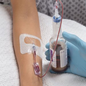 Kurin PIV sidelines skin contaminants for blood culture collections from a fresh peripheral IV catheter.