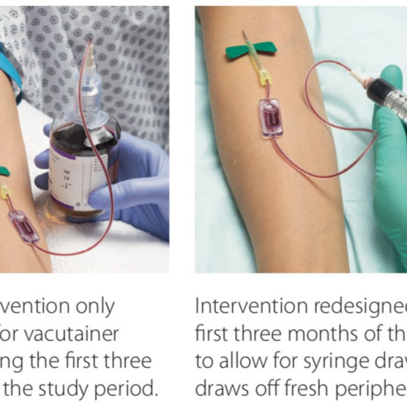 preventing-blood-culture-contamination-kurin